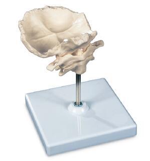 带有枕骨片的寰椎和枢椎组合