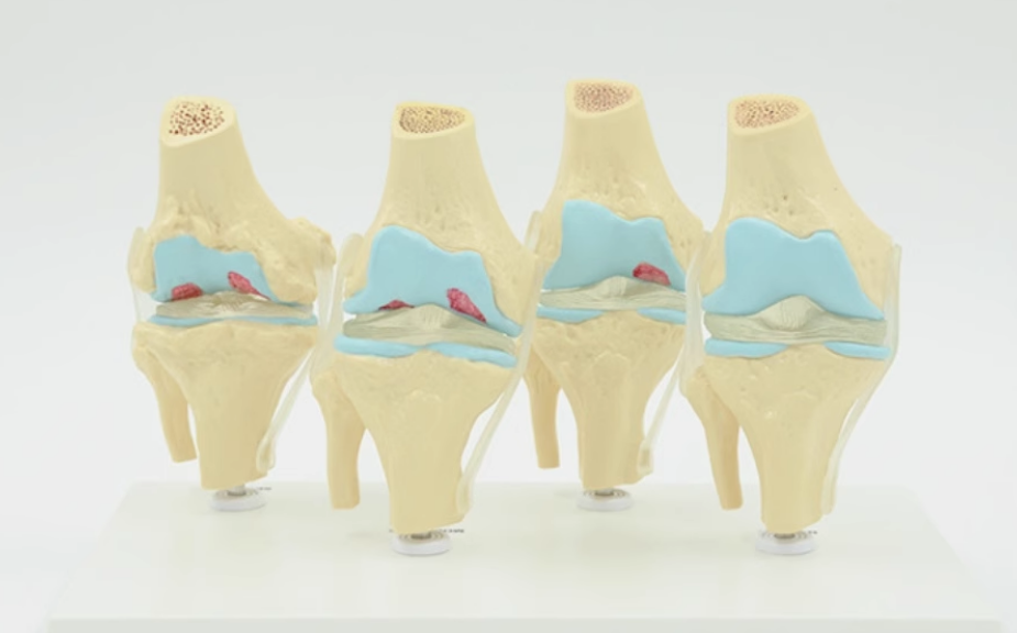 四阶段膝关节模型