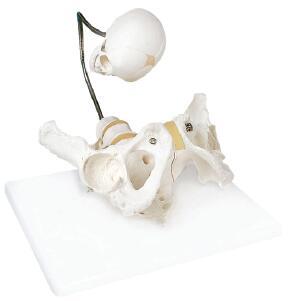 女性骨盆附胎儿头颅骨模型