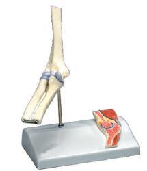 肘关节附矢状剖面模型