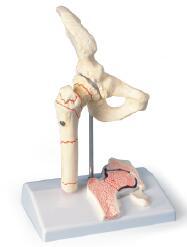 髋关节附矢状剖面模型