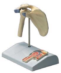 肩关节附矢状剖面模型