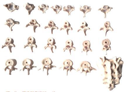 颈、胸、腰椎骶骨模型(26块)