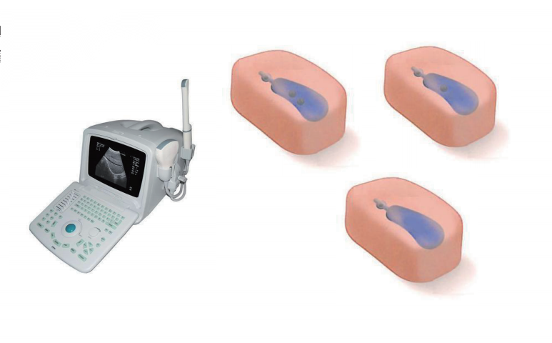 胆囊超声检查训练模型