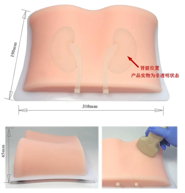 超声引导下肾脏穿刺模型