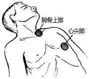 心肺复苏术 心肺复苏术