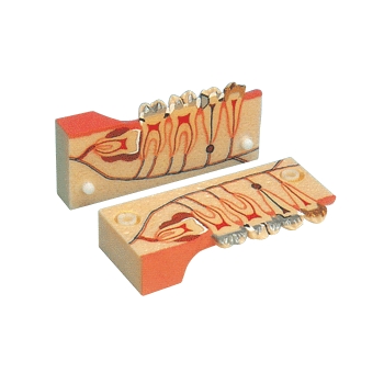 牙分解组织模型