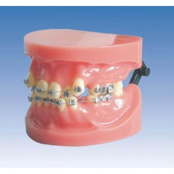 固定矫正模型(错位)