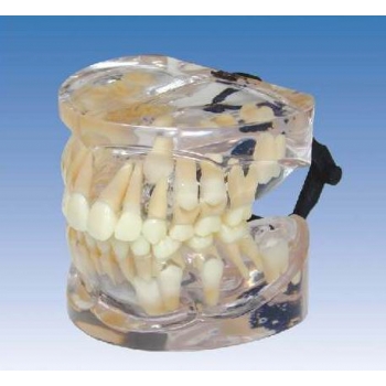 九岁乳恒牙交替牙模型