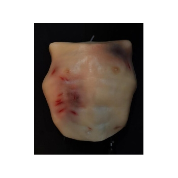 穿戴式血气胸穿刺组件