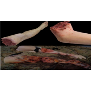 四肢与结合部止血高级套装