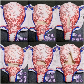 妊娠子宫三维血管构造软体模型(6类)